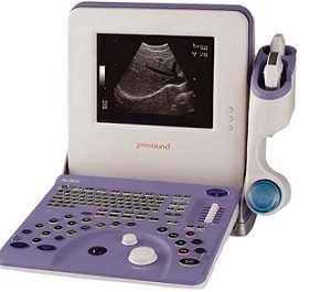 Ultrasound-Prosound-2-Aloka-Japan